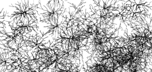 Brain distraction by constant stimulation